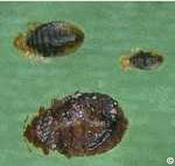 bed bugs of varying age and size